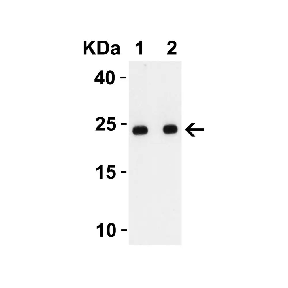 ProSci 9169_S SARS-CoV-2 (COVID-19) Envelope Antibody, ProSci, 0.02 mg/Unit Secondary Image